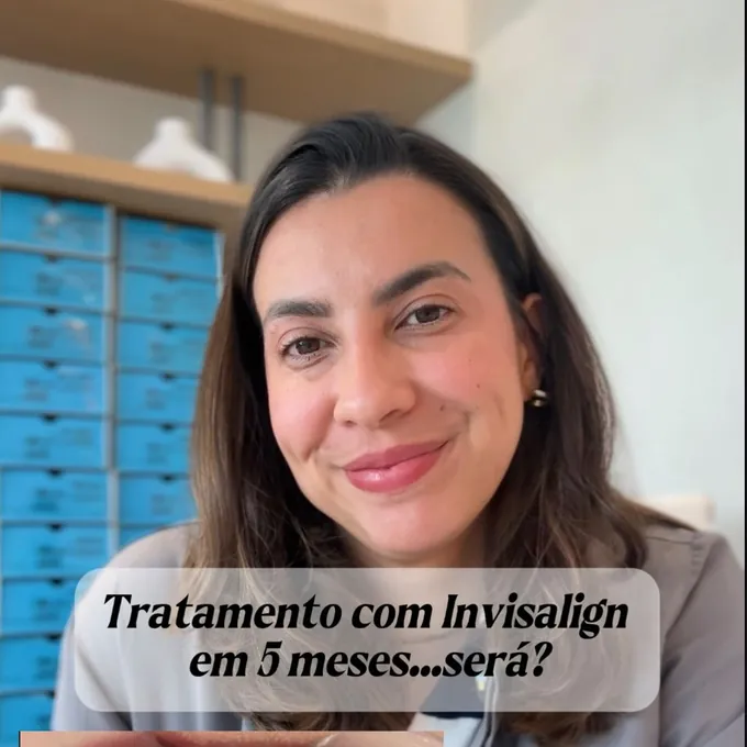 Tratamento com Invisalign em 5 meses