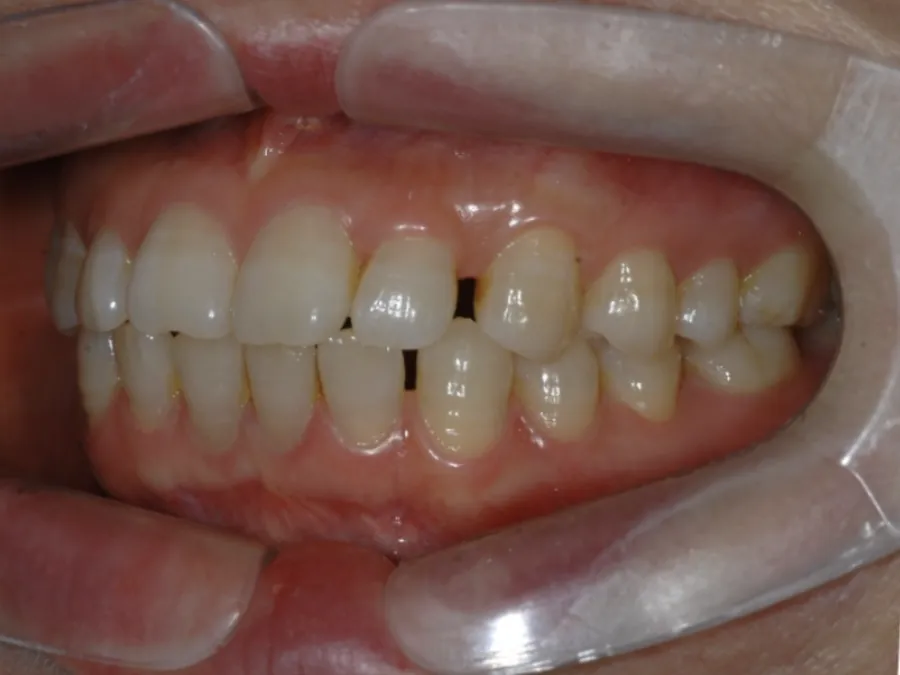 Registro intraoral de acompanhamento