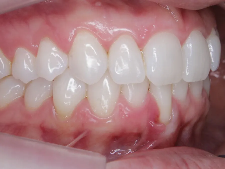 Registro intraoral de acompanhamento