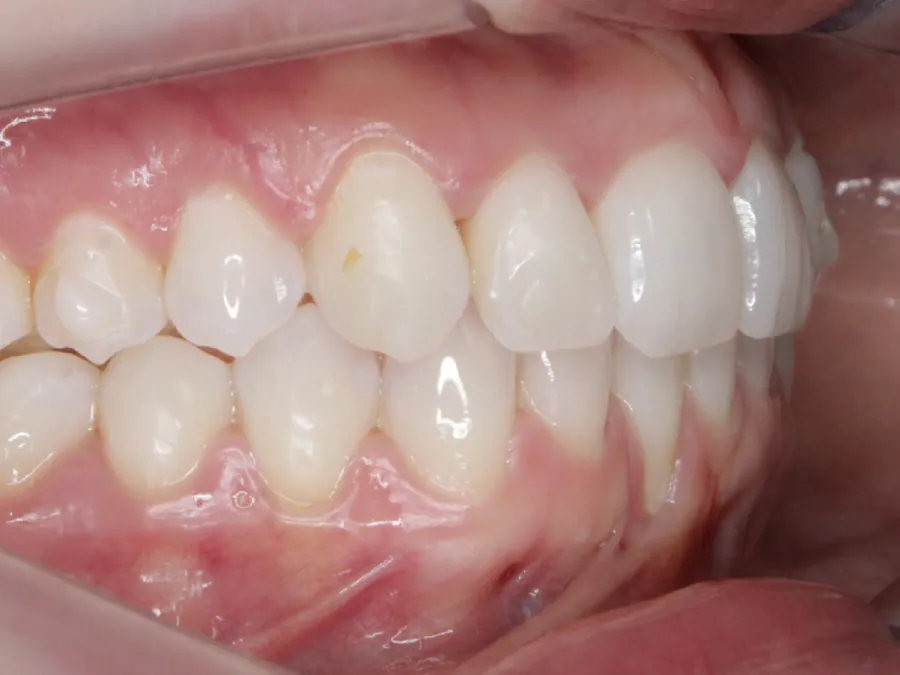 Registro intraoral de acompanhamento