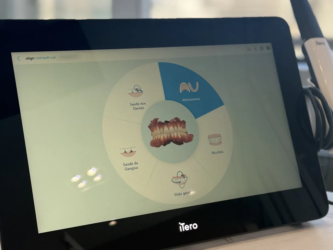 Tela do iTero com a análise de saúde dos dentes e da gengiva